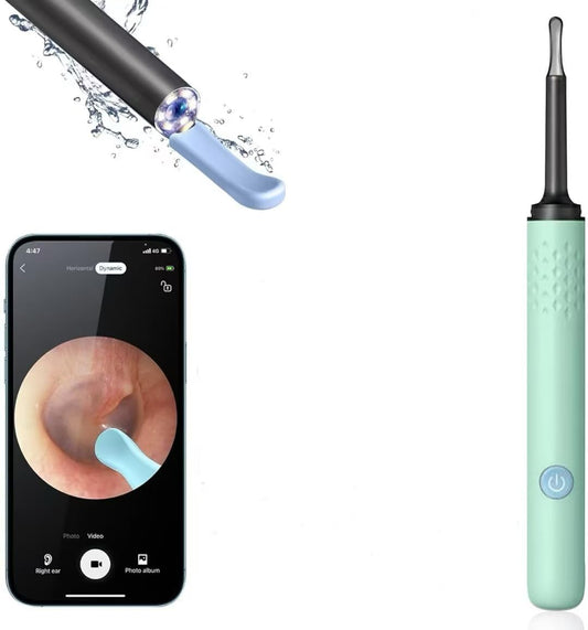 Ear Wax Removal Ear Cleaner with Camera Ear Camera Otoscope with Light Ear Cleaning Kit